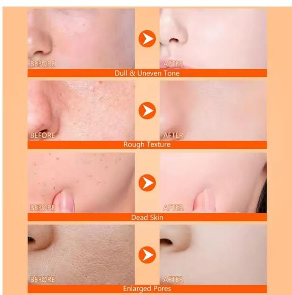 GlowShot Kojic Turmeric Spray